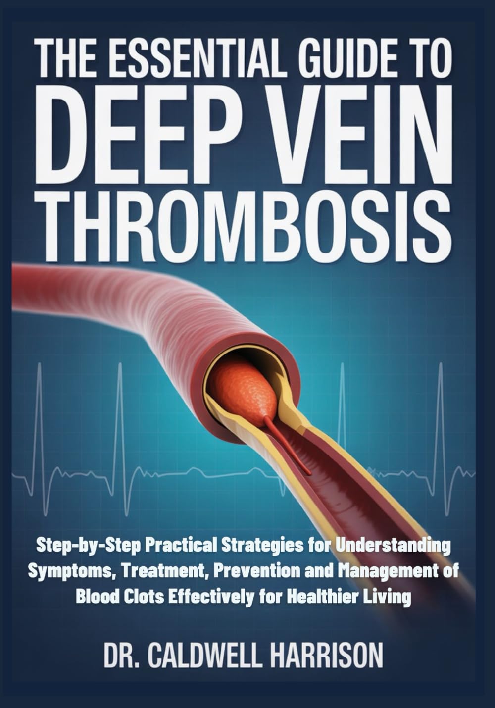 The Essential Guide to Deep Vein Thrombosis: Step-by-Step Practical Strategies for Understanding Symptoms, Treatment, Prevention and Management of Blood Clots Effectively for Healthier Living