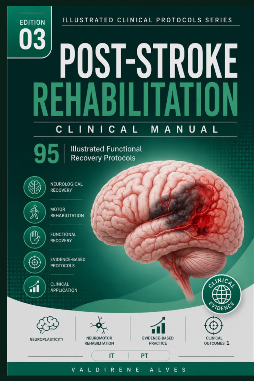 Post-Stroke Rehabilitation Clinical Manual: 95 Illustrated Functional Recovery Protocols