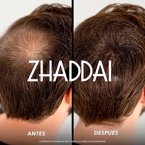 Creatinas, Imagen adicional