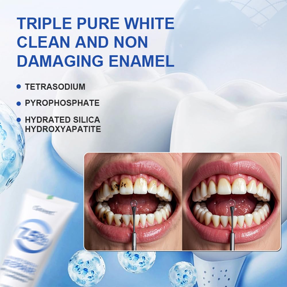 Amazon | アパタイト 歯磨き粉, 7.5% Hydroxyapatite Toothpaste, For