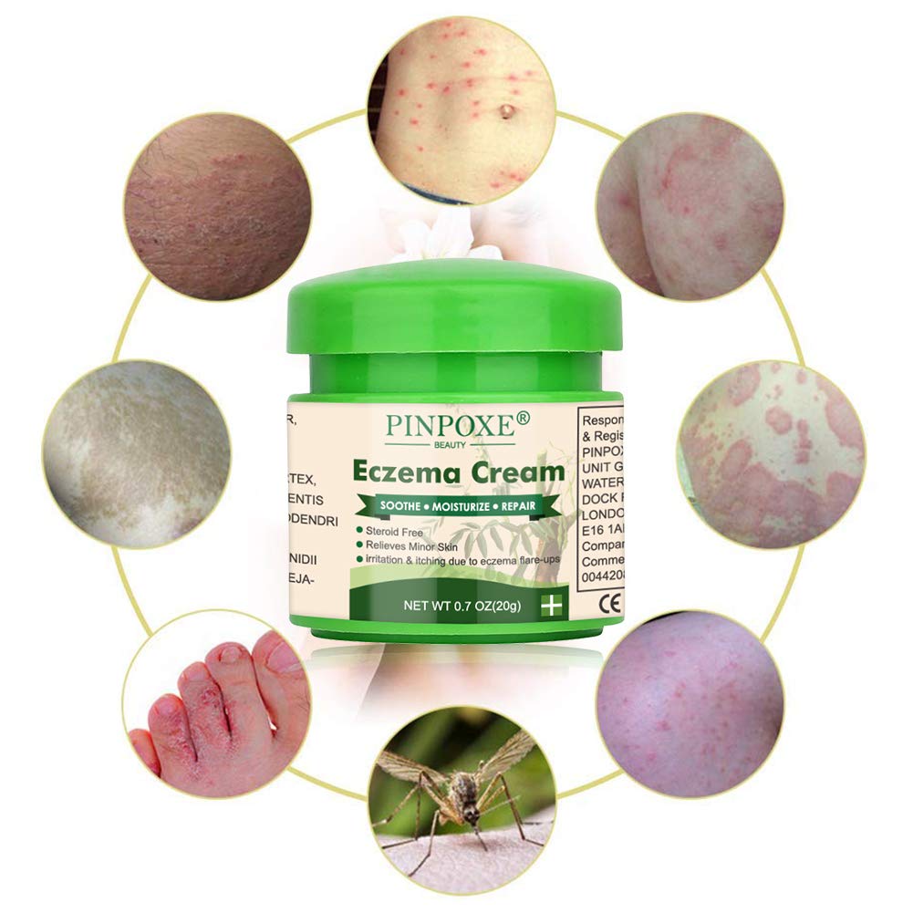 Eczema Cream, Eczema Therapy, Psoriasis Cream for Dry, Irritated Skin