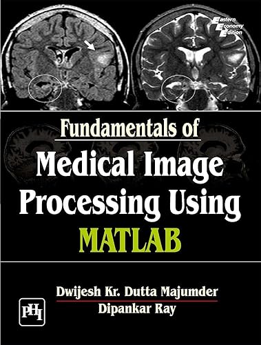FUNDAMENTALS OF MEDICAL IMAGE PROCESSING USING
