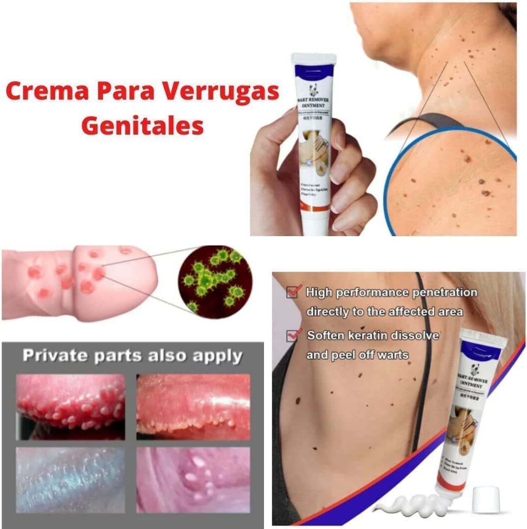 Remover Wart Ointment Genital Genital Vulva Condyloma Acuminatum,Remover Wart Ointment Genital, Genitals Wart Treatment Cream, Plantar and Genital Wart Treatment (2pcs)