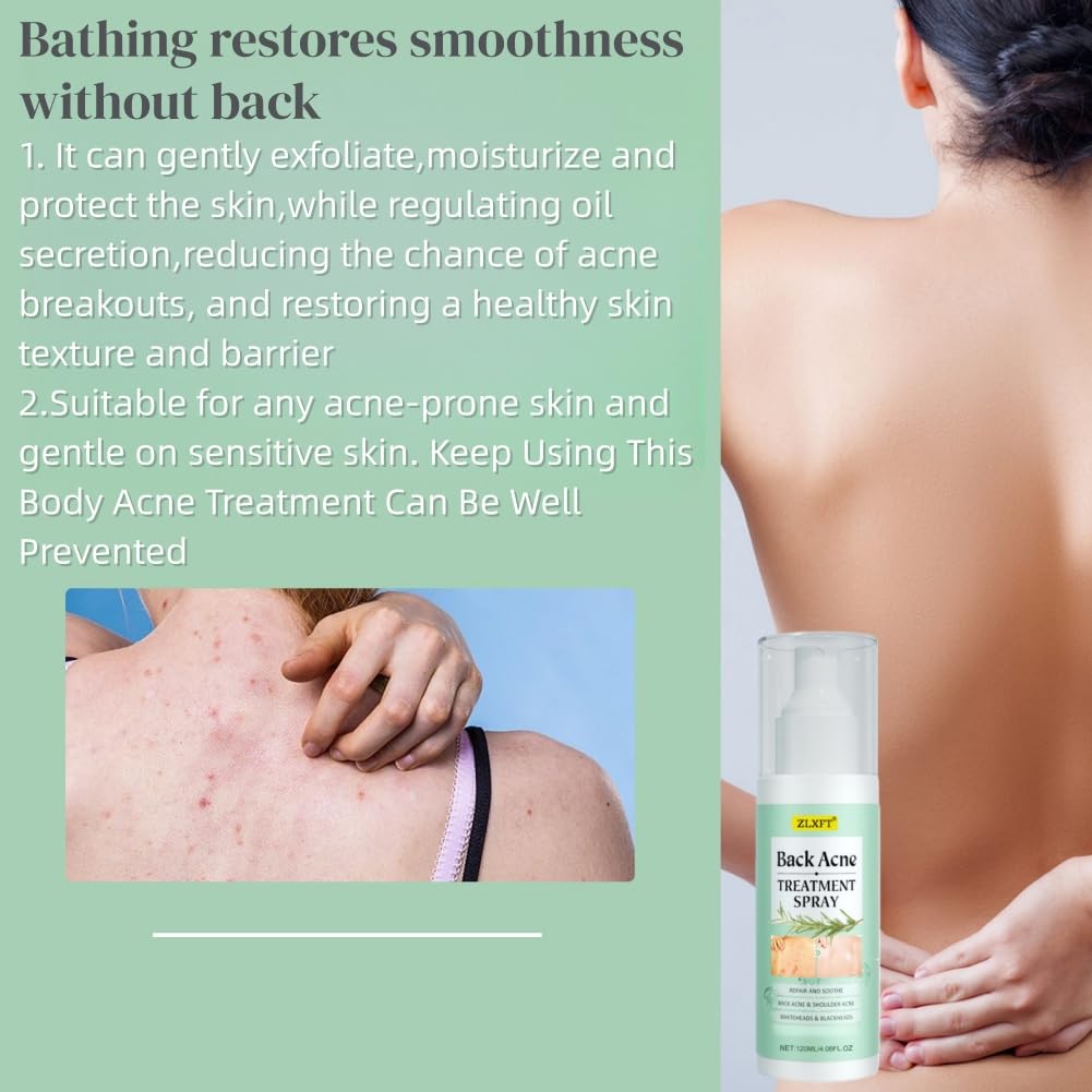 Torna Soluzione Brufolo,2pcs Spray per Brufoli Corpo,Spray per la Rimozione dei Brufoli Sulla Schiena,Post Acne Trattamento Sprays,Acnes Sprays Back And Chest,Body Acnes Sprayss