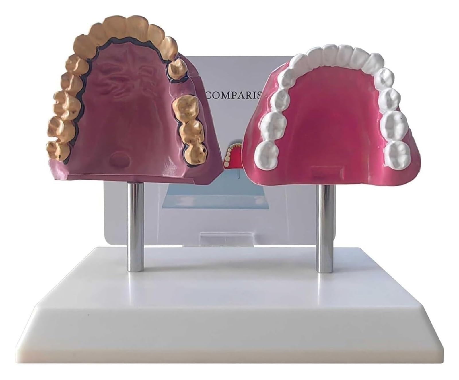 Modello anatomico dei denti orali umani | Modello comparativo di denti fumatori e denti sani con struttura anatomica accurata