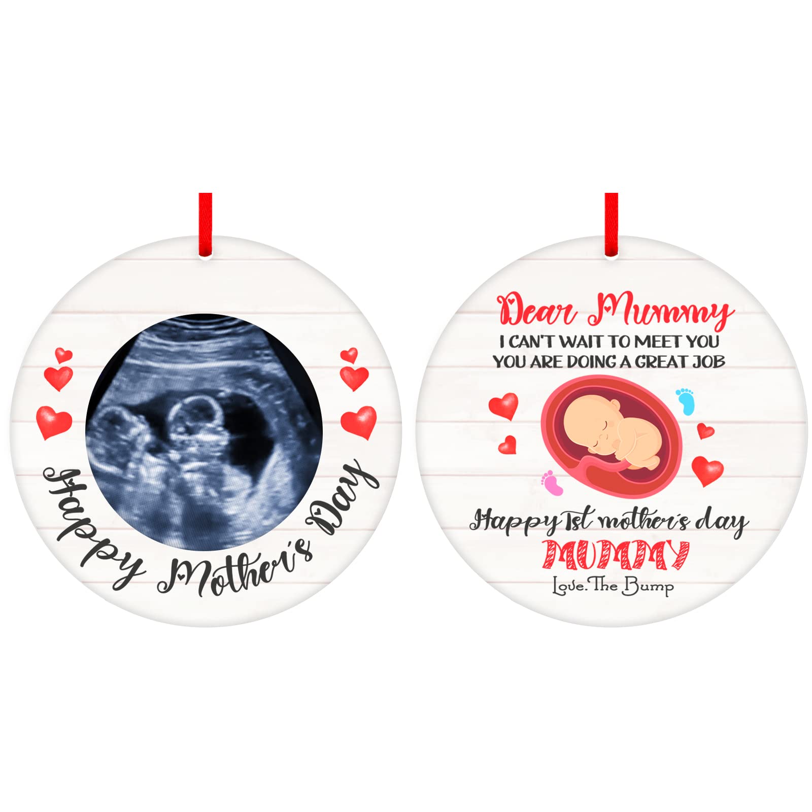 First Mothers Day Ornaments Gifts Bump Ultrasound Picture Frame Ornaments to be New Mom Expecting Mother Baby Sonogram Photo Frame Ornament Pregnant