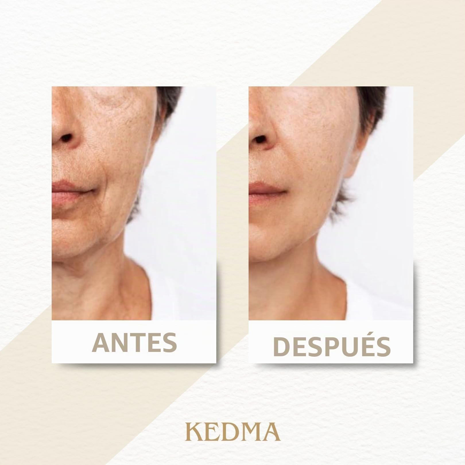KEDMA - Crema Facial con Oro 24K y Minerales del Mar Muerto - 50g | La crema facial con oro 24K y minerales del Mar Muerto hidrata y ayuda a recuperar la luminosidad.