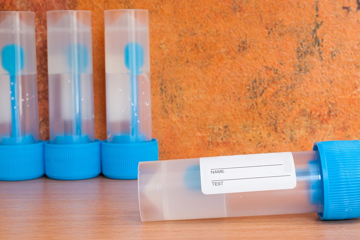 Produktbild von 20 Stück Kotprobenröhrchen Für Hunde & Katzen – 15 Ml PP-Röhrchen Mit Löffel & Etiketten, Für Pathologische Untersuchungen, Dicht Verschließbar