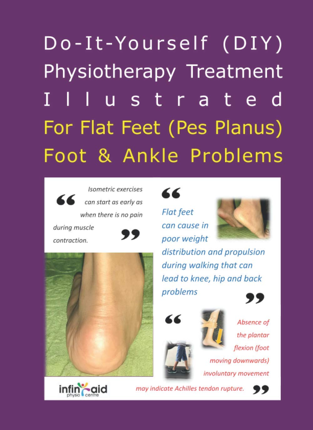 Hip Pain Problems Flat Feet Can Cause Flat Feet Hip Problems
