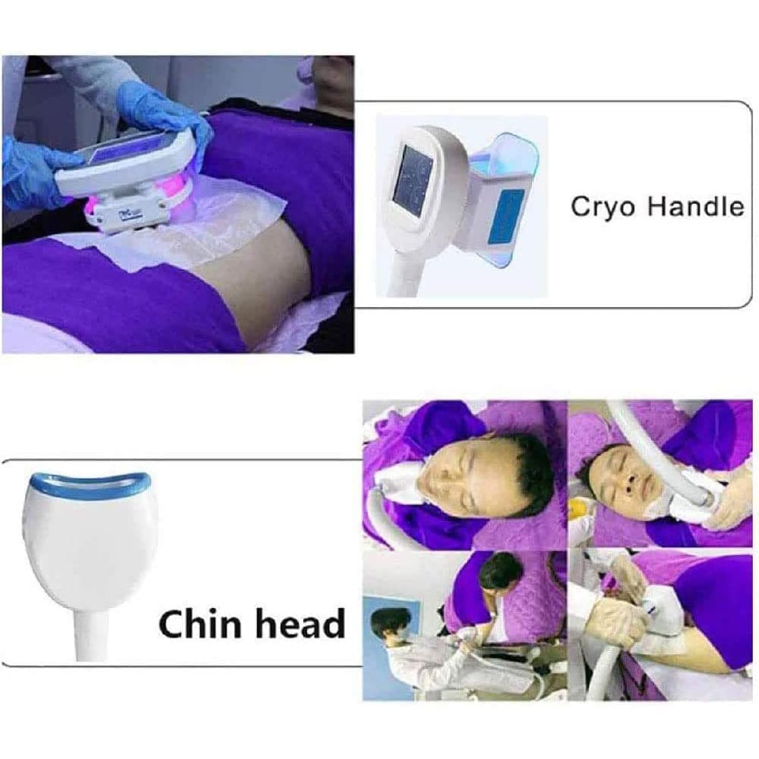 Körperschlankheitsmaschine, Fett-Lipolyse-Instrument, Körperformung, Cellulite-Verbrennung, Spa-Verwendung, mit 3 Betriebsköpfen – Vakuum-Fett-Schlankheitsgerät
