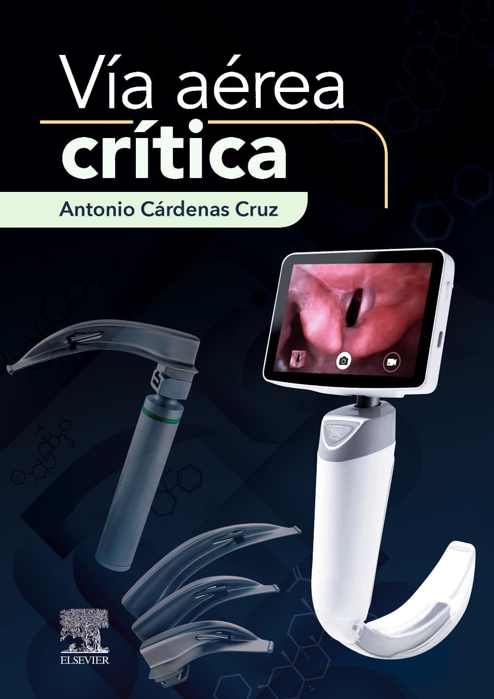 Vía aérea crítica