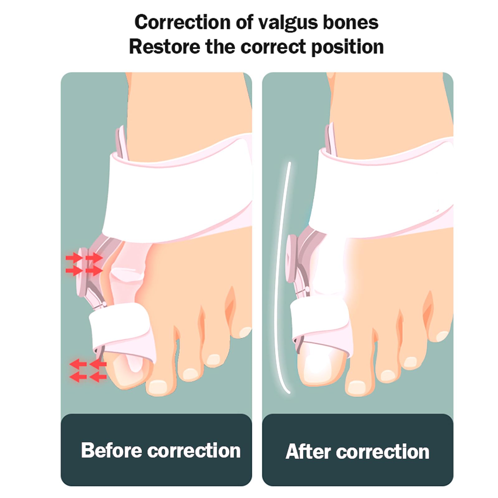 Alisador De Férula Para Juanetes, Corrección Ortopédica Ajustable De Juanetes, Corrector De Juanetes Con Perilla De Ajuste Y Escala, Rotación Flexible De 180°, Para Mujeres Y Hombres, Dedo Gordo
