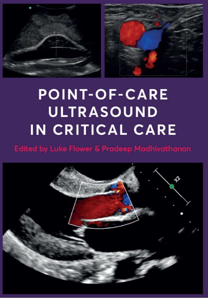 Point-of-Care Ultrasound in Critical Care: a practical guide to POCUS