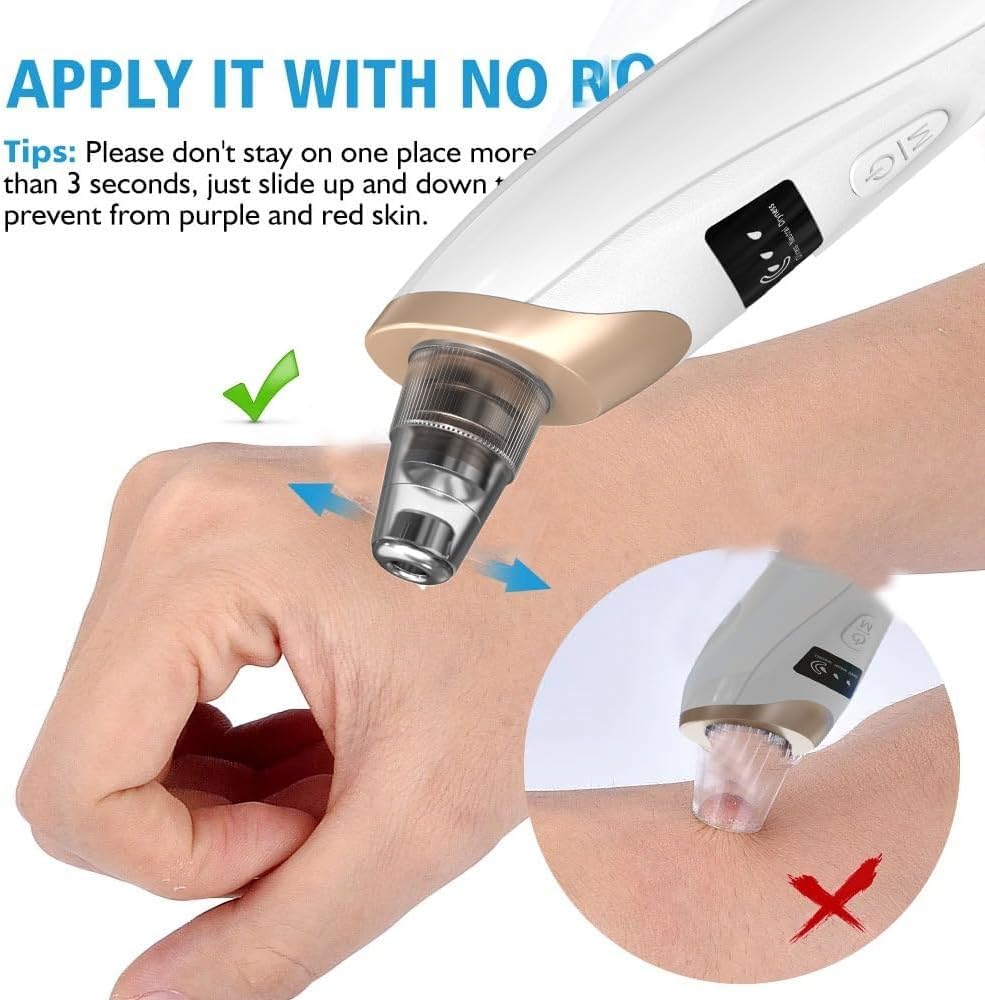 Extracteur de points noirs professionnel pour le visage avec 3 niveaux d'aspiration réglables, nettoyeur de pores rechargeable par USB et 5 sondes interchangeables (blanc cassé)