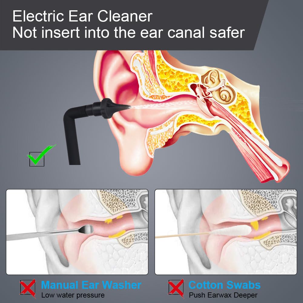 Ohrenschmalz Entferner, Elektrischer Ohrenreiniger, Ohrreiniger mit 6 Düsen und 4 Druckmodi, IPX6 wasserdicht, USB-aufladbar, Ohrendusche Ear Cleaner für Erwachsene Kinde