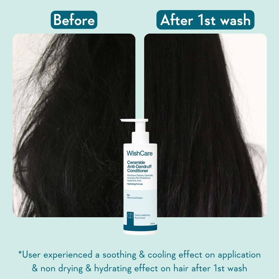 WishCare Ceramide Anti Dandruff Conditioner | Reduces Dandruff & Scalp Itchiness | Conditioner For Dry Hair, Frizzy Hair | With Piroctone Olamine & Hyaluronic Acid | 200ml 2
