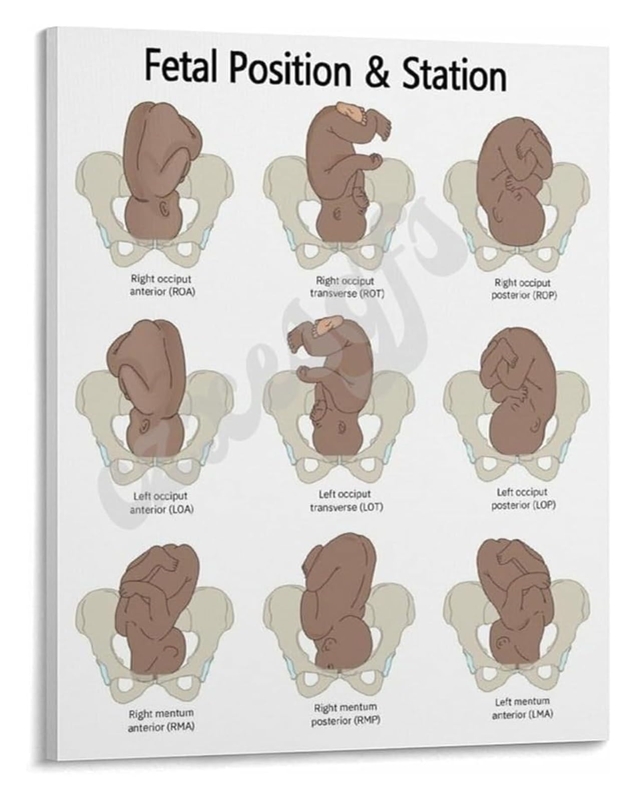 Kcdfdvjfbm Unframed Ob Nursing Guide Fetal Position Station Chart Poster Educational Canvas Print For Labor And Delivery Unit Decor(,16X24inch(40X60cm))