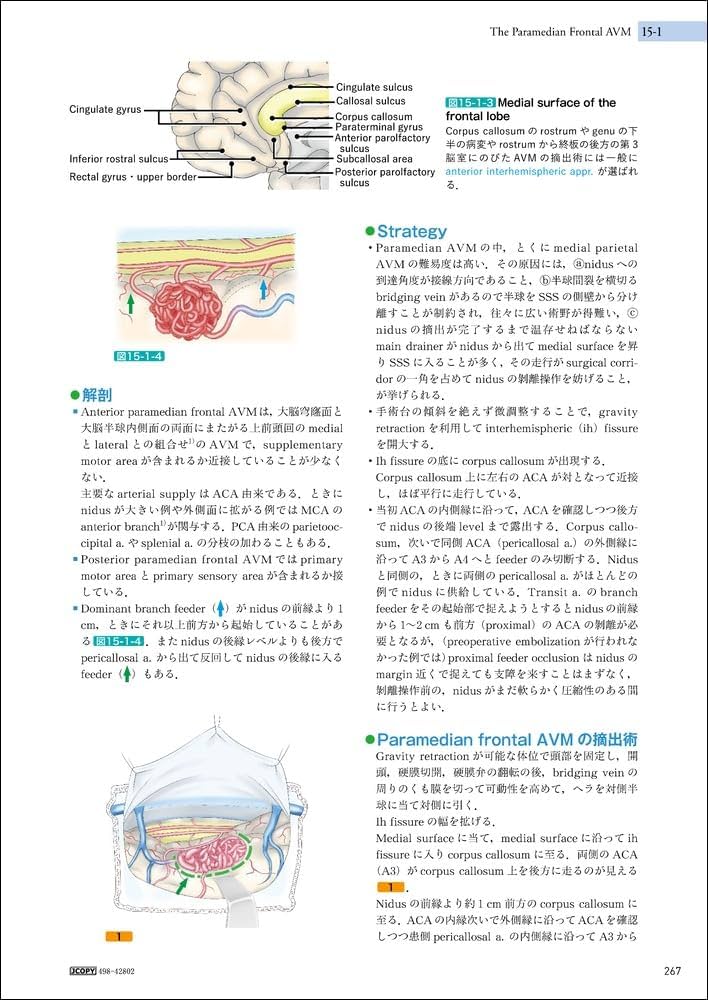 脳動静脈奇形の手術 | 富永 紳介 |本 | 通販 | Amazon
