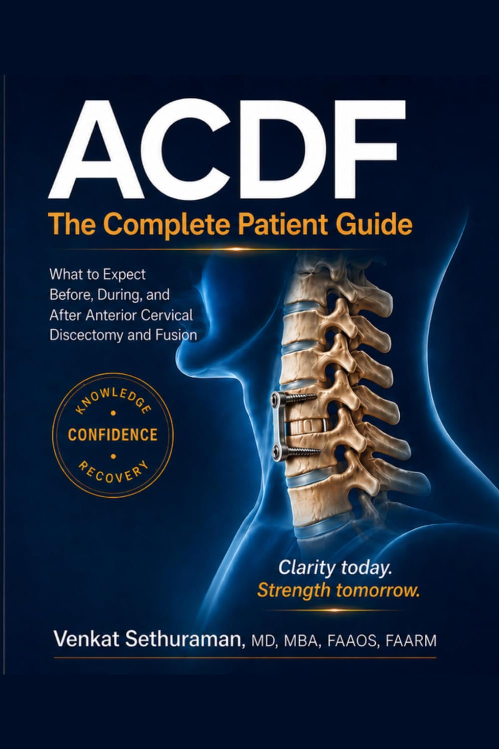 Understanding ACDF: A Patient's Complete Guide to Anterior Cervical Discectomy and Fusion