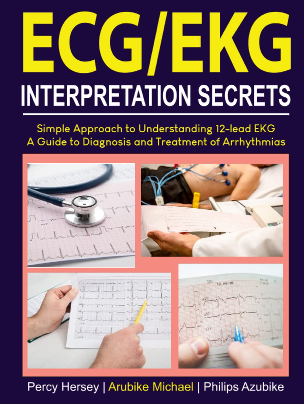 ECG/EKG INTERPRETATION SECRETS: Simple Approach to Understanding 12-Lead EKG. A Guide to Diagnosis and Treatment of Arrhythmias