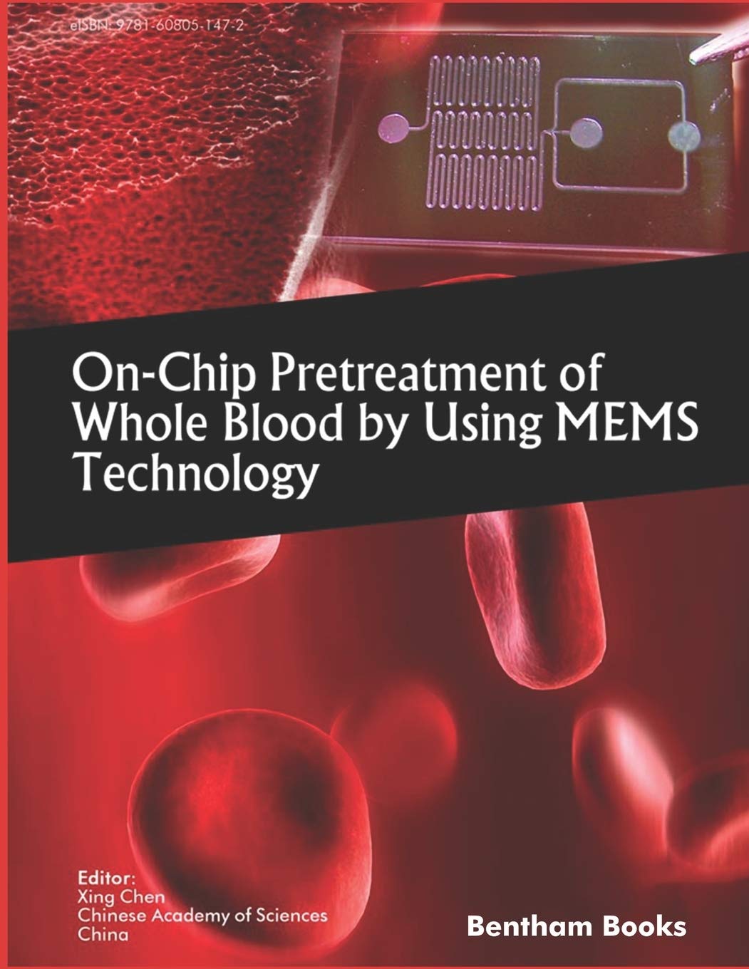 Buy On-Chip Pretreatment of Whole Blood by Using MEMS Technology — BookShops.in