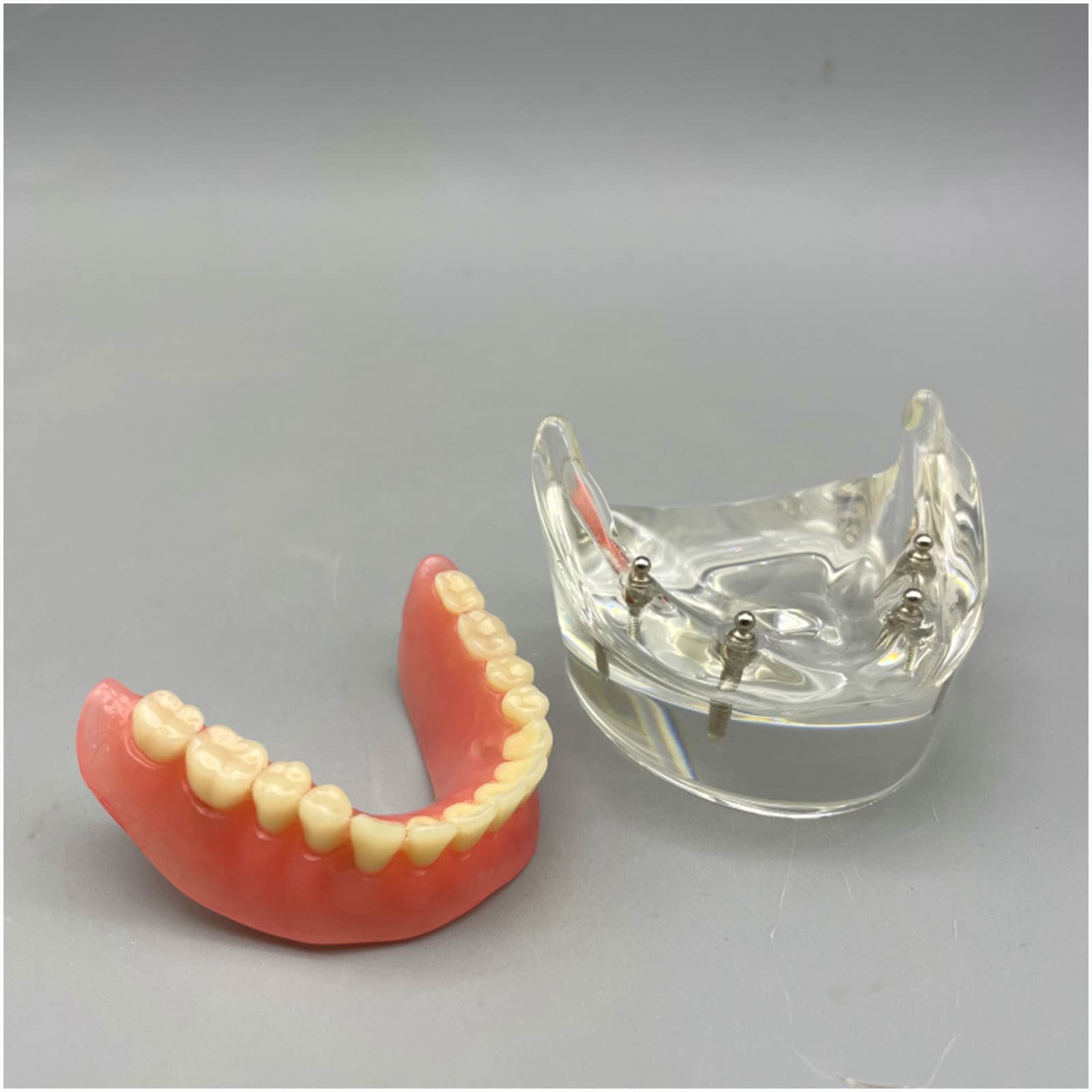 Zahnimplantat Modell - Overdenture 4 Implantate Modell - Transparentes Demo Dental Zahnmodell für Studie Erwachsene Standard Lehrmodell (Untere Zähne)