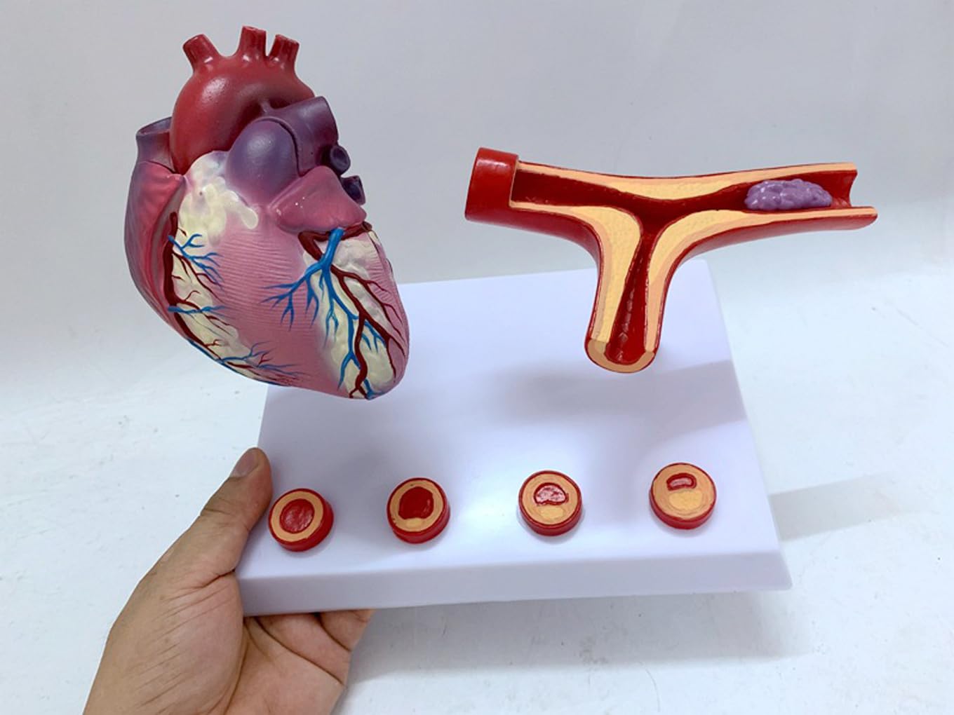 Narzędzia do nauki modelu, nauczanie anatomii serca serca pomostowanie tętnic wieńcowych model z blokadą tętnic i naczyń krwionośnych zakrzepica pomoce dydaktyczne