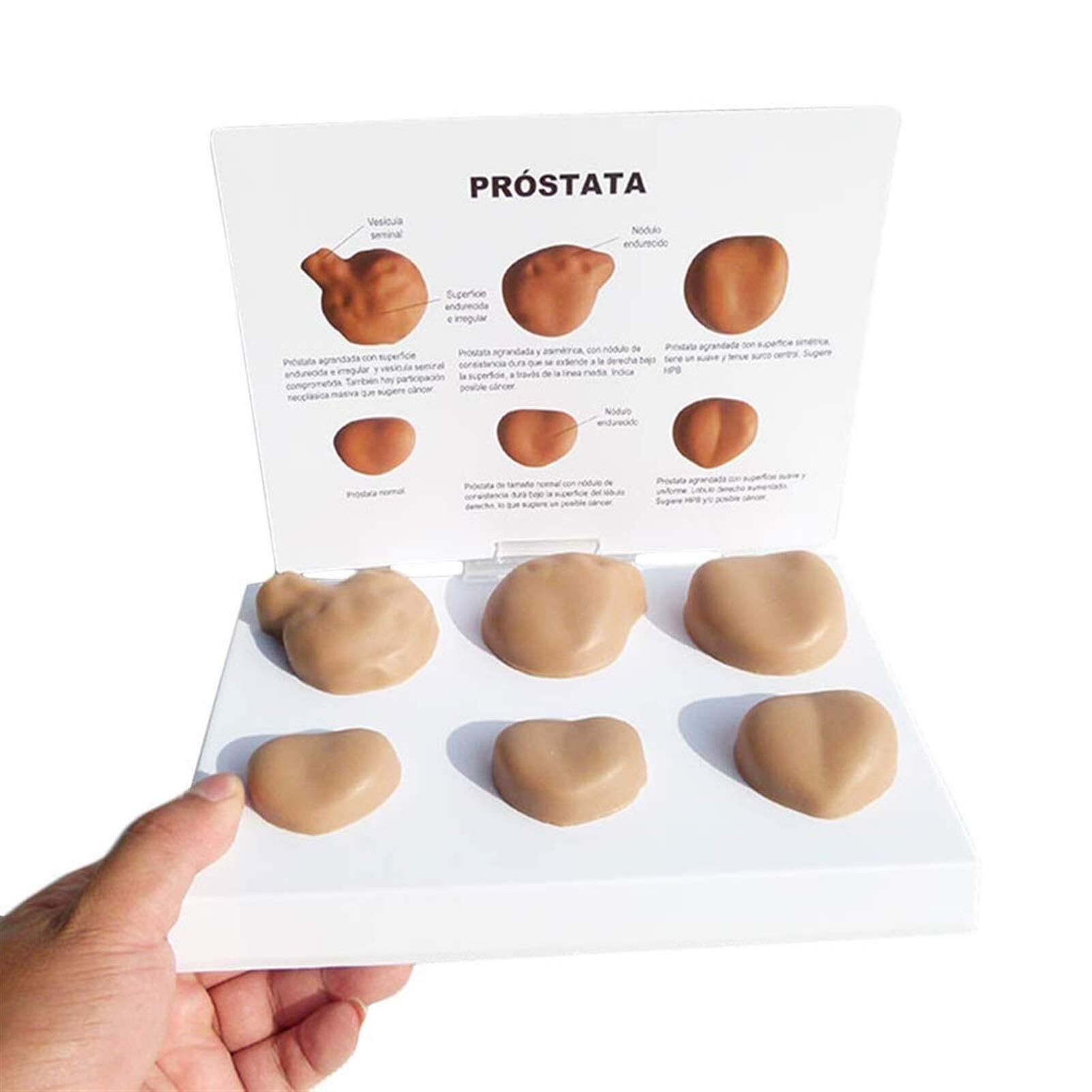 XINGLUOY Male prostate anatomy model, contrast pathology, medical learning teaching