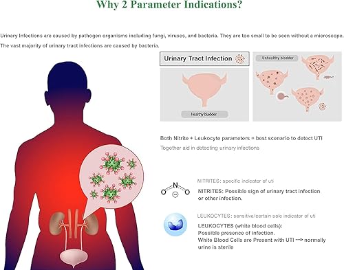 Miniatura 9 de EasyHome 10 tiras de prueba elegibles para la FSA para infección del tracto urinario, kit de prueba de orina UTI para análisis de orina y detección