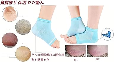 Amazon Fobo5足セット かかと 靴下 ソックス 角質取り 保湿 ひび割れ かかとケア レディース 角質除去 足首用 かかと サポーター 5足入 ピンク グリーン グレー ブルー ブラックm 靴下 通販