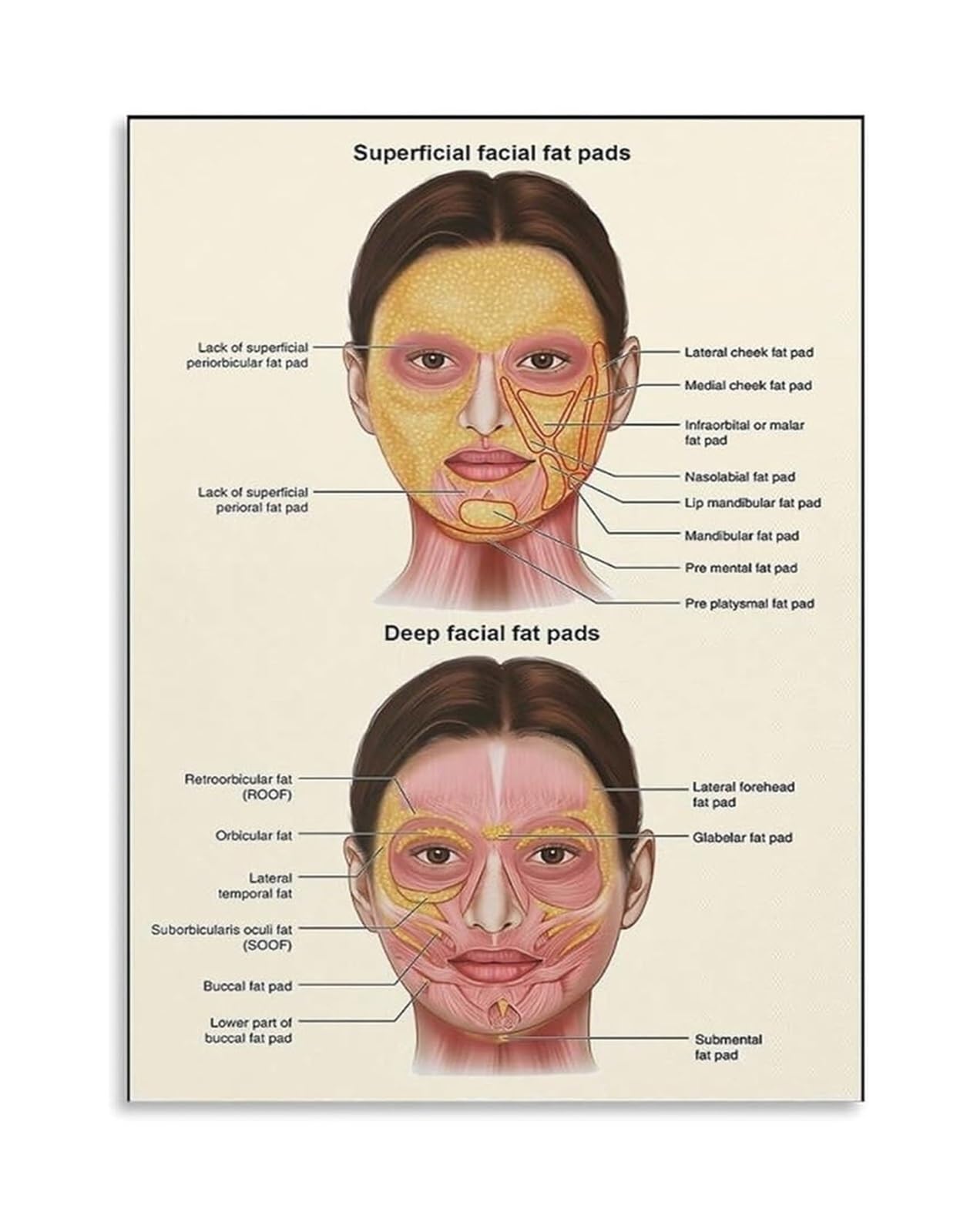 ZDVHOMCB Facial Fat Pads Anatomy Chart Advanced Facial Structure Poster for Surgeons Injectors Office Decor Framed,08x12inch(20x30cm)