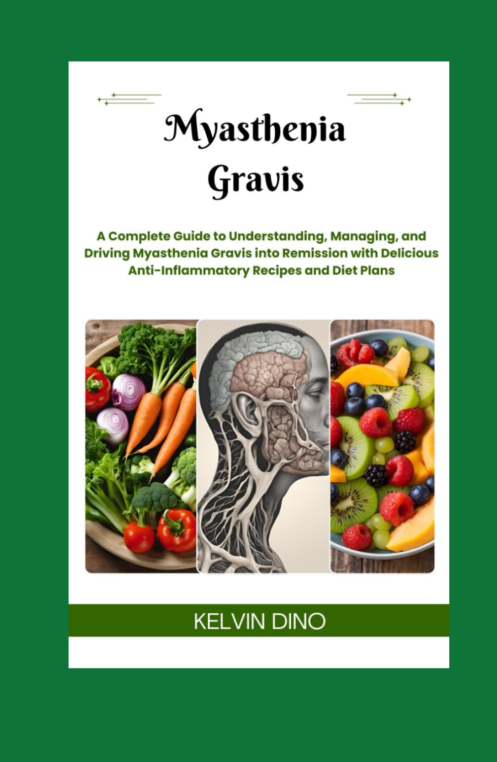 Myasthenia Gravis: A Complete Guide to Understanding, Managing, and Driving Myasthenia Gravis into Remission with Delicious Anti-Inflammatory Recipes and Diet Plans