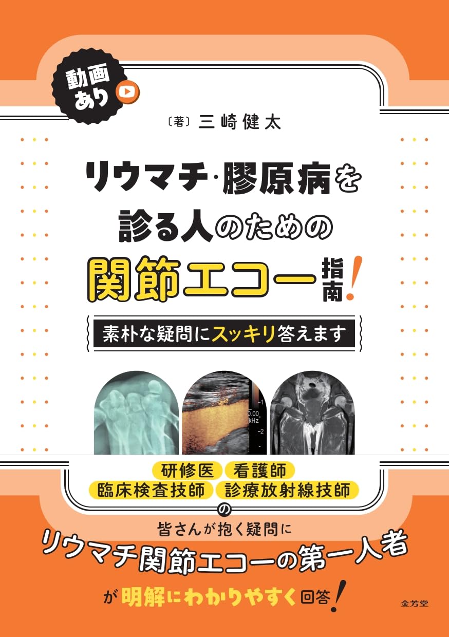 Amazon.co.jp: リウマチ・膠原病を診る人のための関節エコー指南