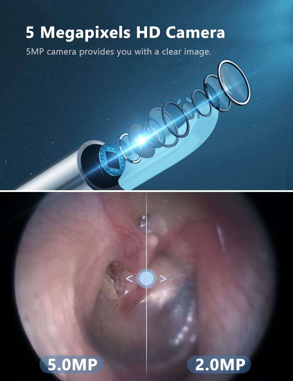 Otoscope Oreille, 5MP HD Kit Camera Oreille d'élimination du cérumen avec 6 lumières LED et une base de stockage, Endoscope Nettoyage Oreille adapté, aux smartphones iOS et Android