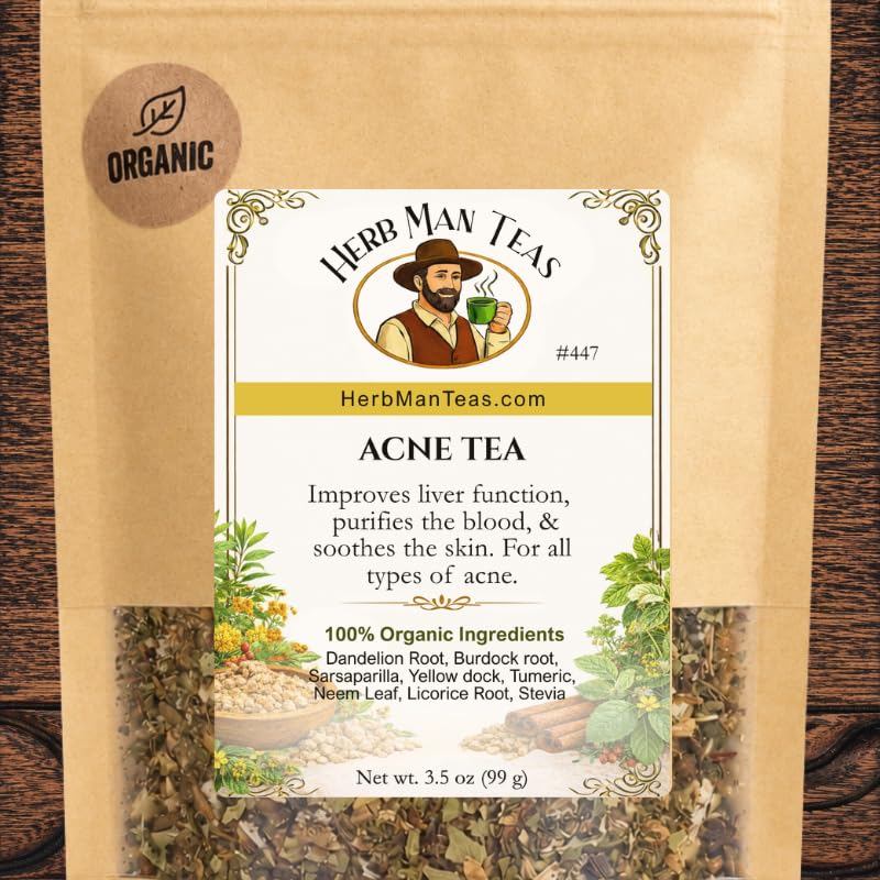 ACNE TEA – Traditionally Used to Support Clear Skin & Complexion with Burdock, Dandelion, Neem &...