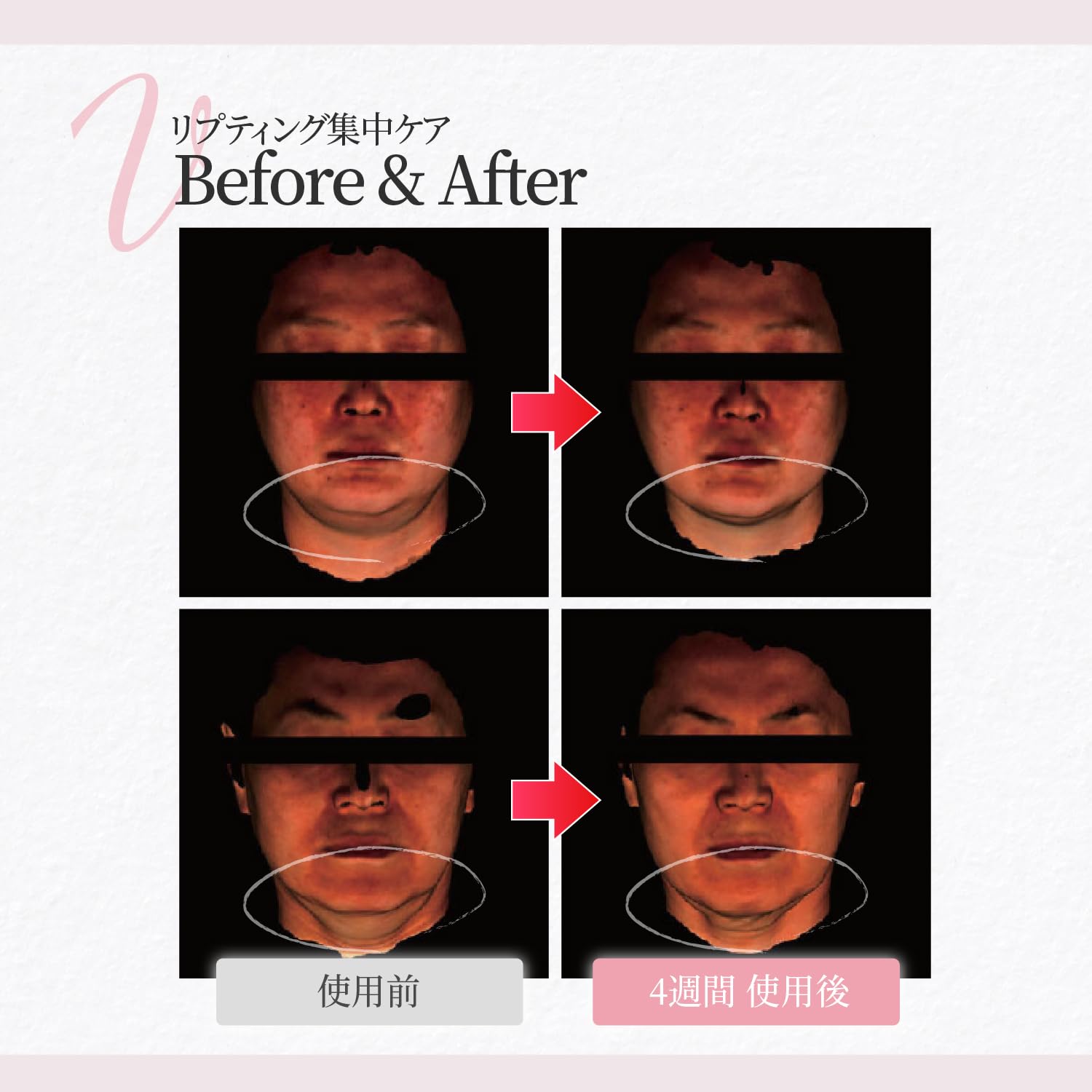 Amazon.co.jp: Labottach 小顔マスク フェイスライン リフトアップ