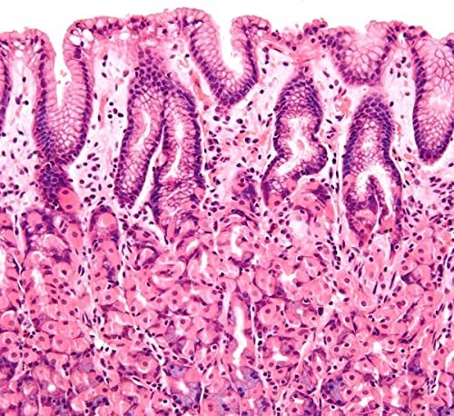 Image of Set of 100 Microscope Prepared Typical Histology Slides for Medical Study Education Teaching