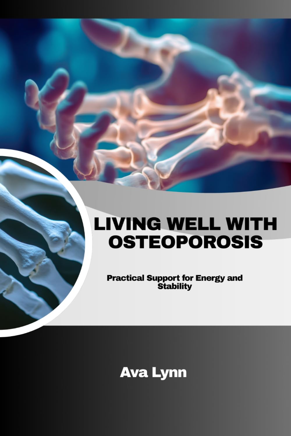 LIVING WELL WITH OSTEOPOROSIS: Practical Support for Energy and Stability