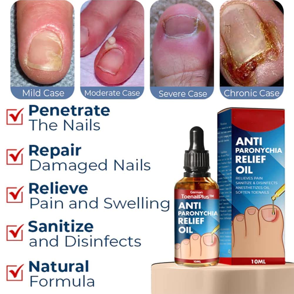 German Toenailplus Anti Paronychia Relief Oil,10ML Anti Paronychia Relief Oil, Ingrown Toenail Drops, Nail Helper Ingrowth Toenail Correction Treatment Oil Zehennagel Tropfen (4PC)