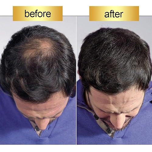 Miniatura 9 de Relleno de fibras capilares de 3.53 oz 3.5 oz. Fijar calvo. Fácil de usar. Para botellas de recarga. Negro). Descúbrelo, pruébalo, recupera tu