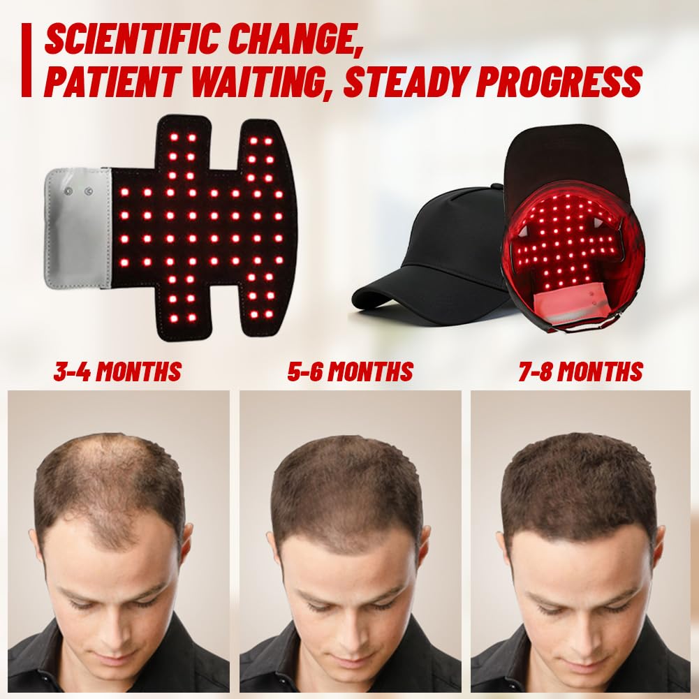 Rotlicht Haarwachstumskappe Anti-Haarausfall für Frauen und Männer, 4 Modi mit 3 Wellenlängen 660+450+850nm, Abnehmbares Panel und Einstellbare Größe, Haarwuchsförderndes Gerät für tägliche Haarpflege