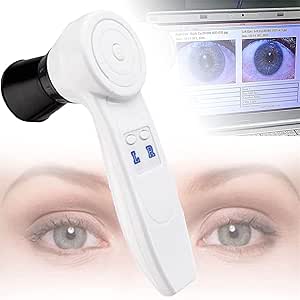 Fotocamera Per Iridologia 5.0 MP USB - Analizzatore Iride Computer, Lente 30X, Software Included - Foto 10