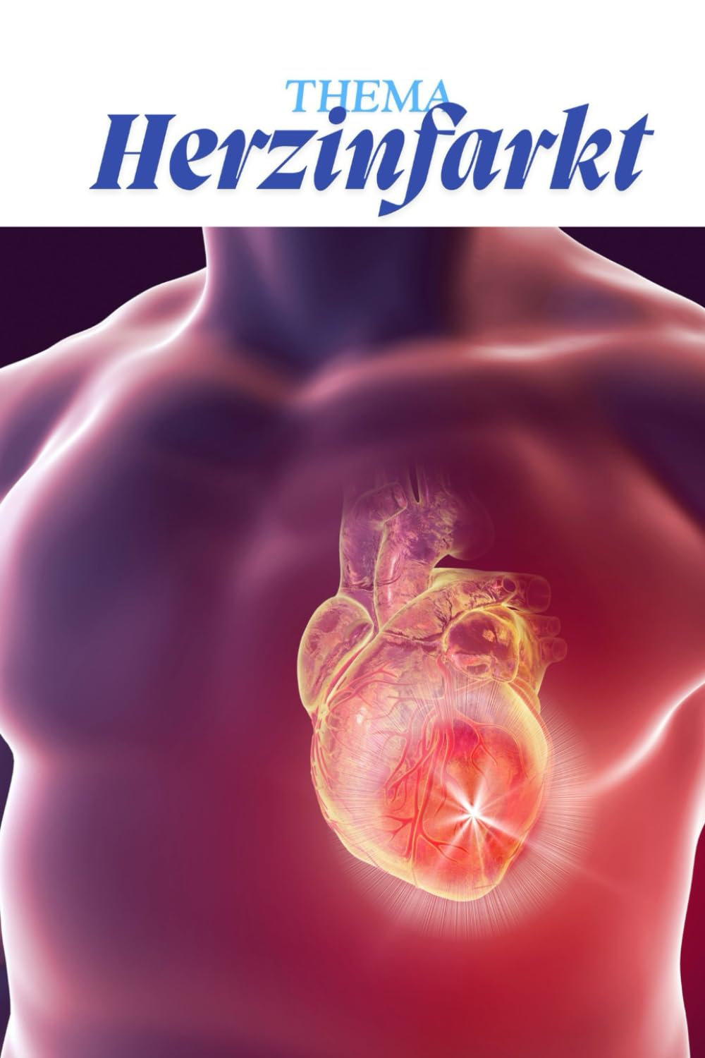 Herzinfarkt kompakt – Pflegewissen für Auszubildende: Alles, was du wissen musst: Symptome, Diagnostik, Behandlung, Prävention & Übungen („Kompaktwissen Pflege – Die Kittelbuch-Reihe“)