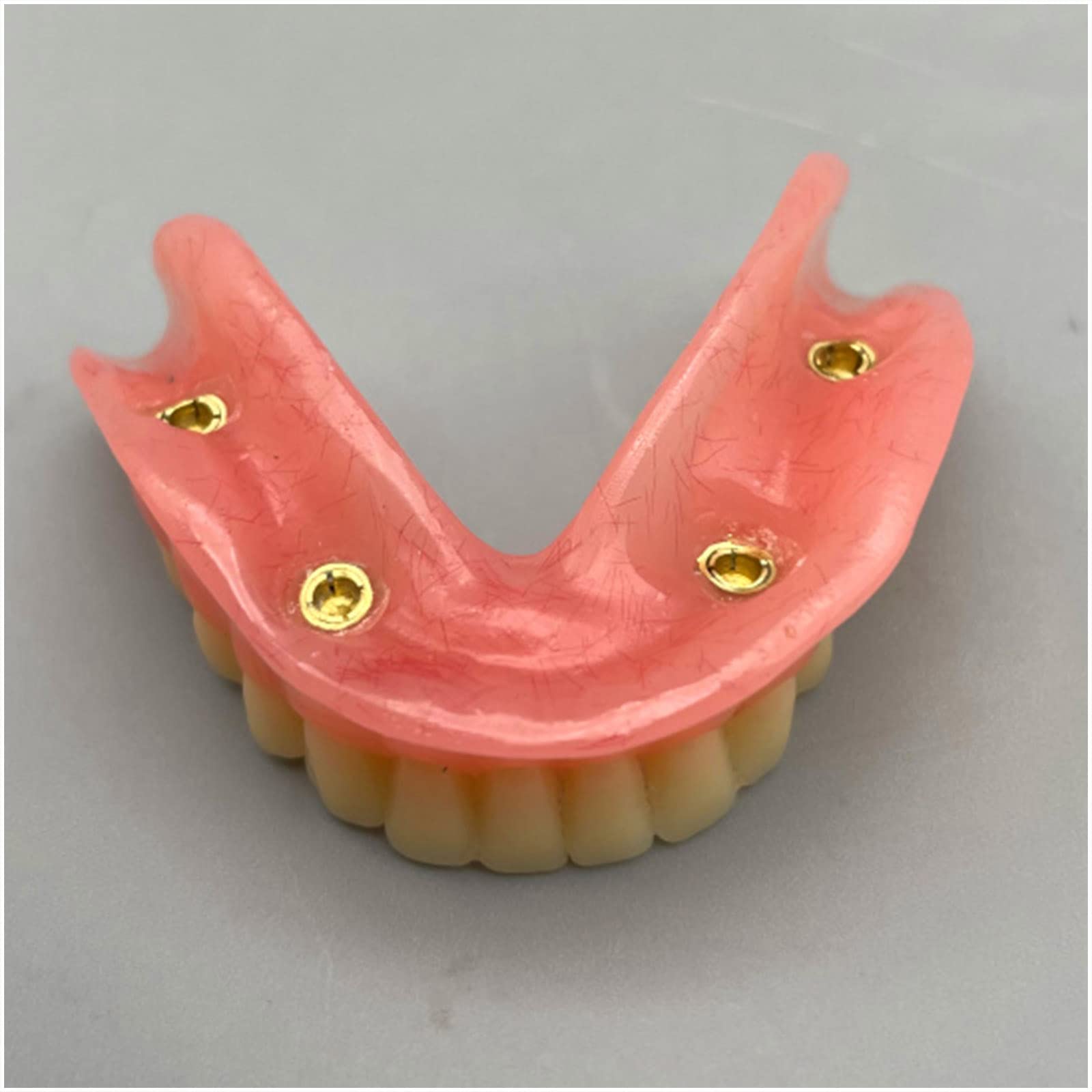 Zahnimplantat Modell - Overdenture 4 Implantate Modell - Transparentes Demo Dental Zahnmodell für Studie Erwachsene Standard Lehrmodell (Untere Zähne)