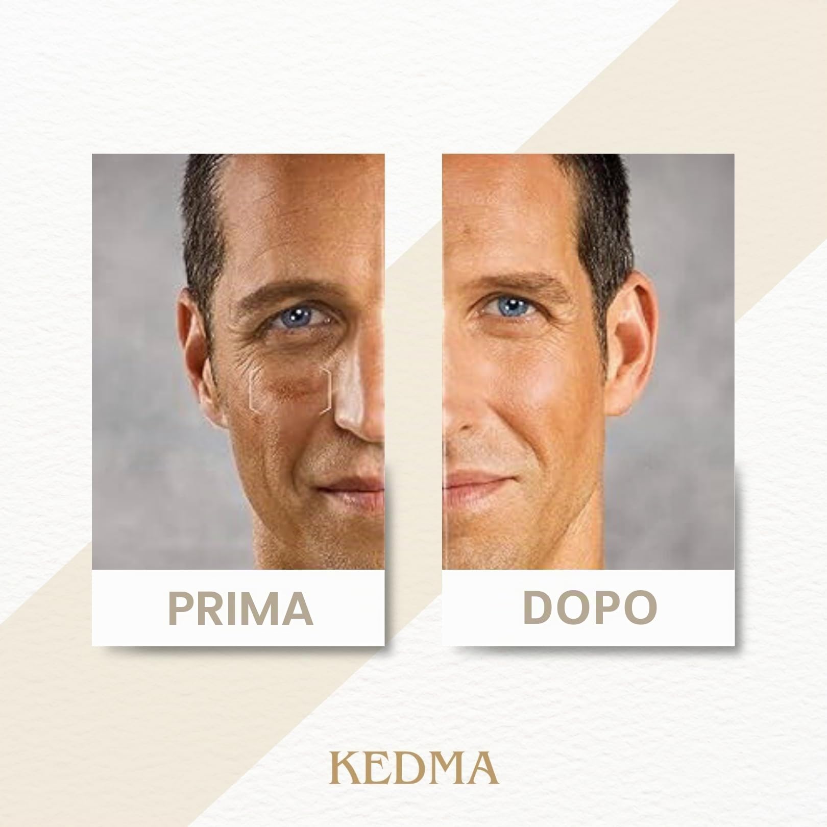 KEDMA - Siero Viso Uomo ai Minerali del Mar Morto - 50g | Il siero viso uomo si assorbe rapidamente, idrata e aiuta a lenire la pelle dopo la rasatura.