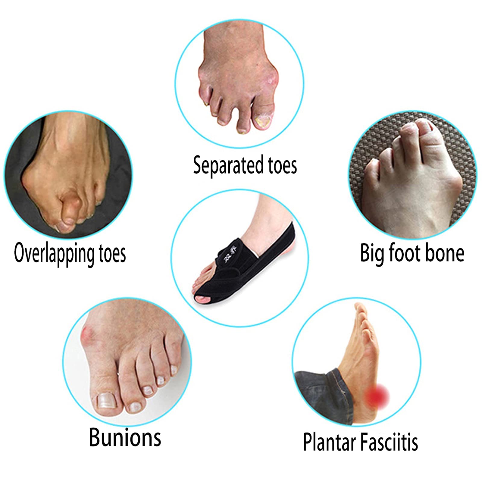 1 para korektorów hallux valgus pedic separatory dużych palców u stóp rękawy łagodzące komfortowy i oddychający materiał dla mężczyzn i kobiet wsparcie na dzień i noc.Bla