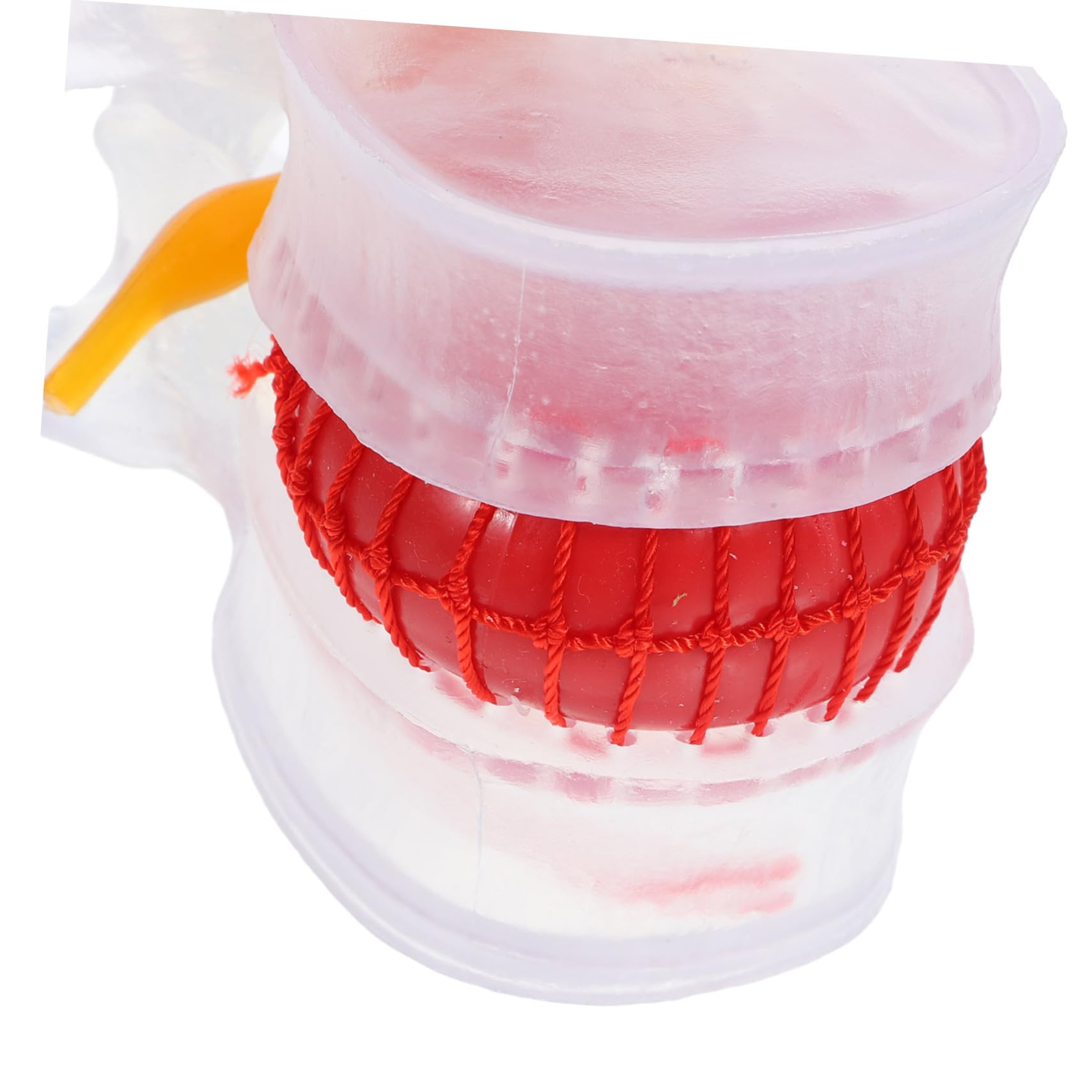 Modelo De Columna Lumbar Modelo De Columna Lumbar Humana Accidente De Columna Lumbar Modelo De Demostración De Software De Resina Transparente Modelo