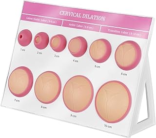 Cervical Dilation Simulator, 10 Stages of Cervical Expansion, Gynecological Childbirth Display Board with Bracket, for Birth Learning, Midwife and Doula Training