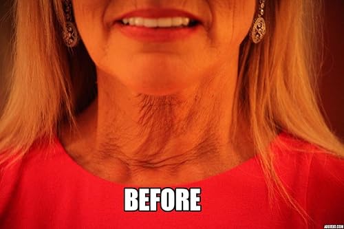 Miniatura 3 de NeckTITE Magic el reafirmante de cuello instantáneo