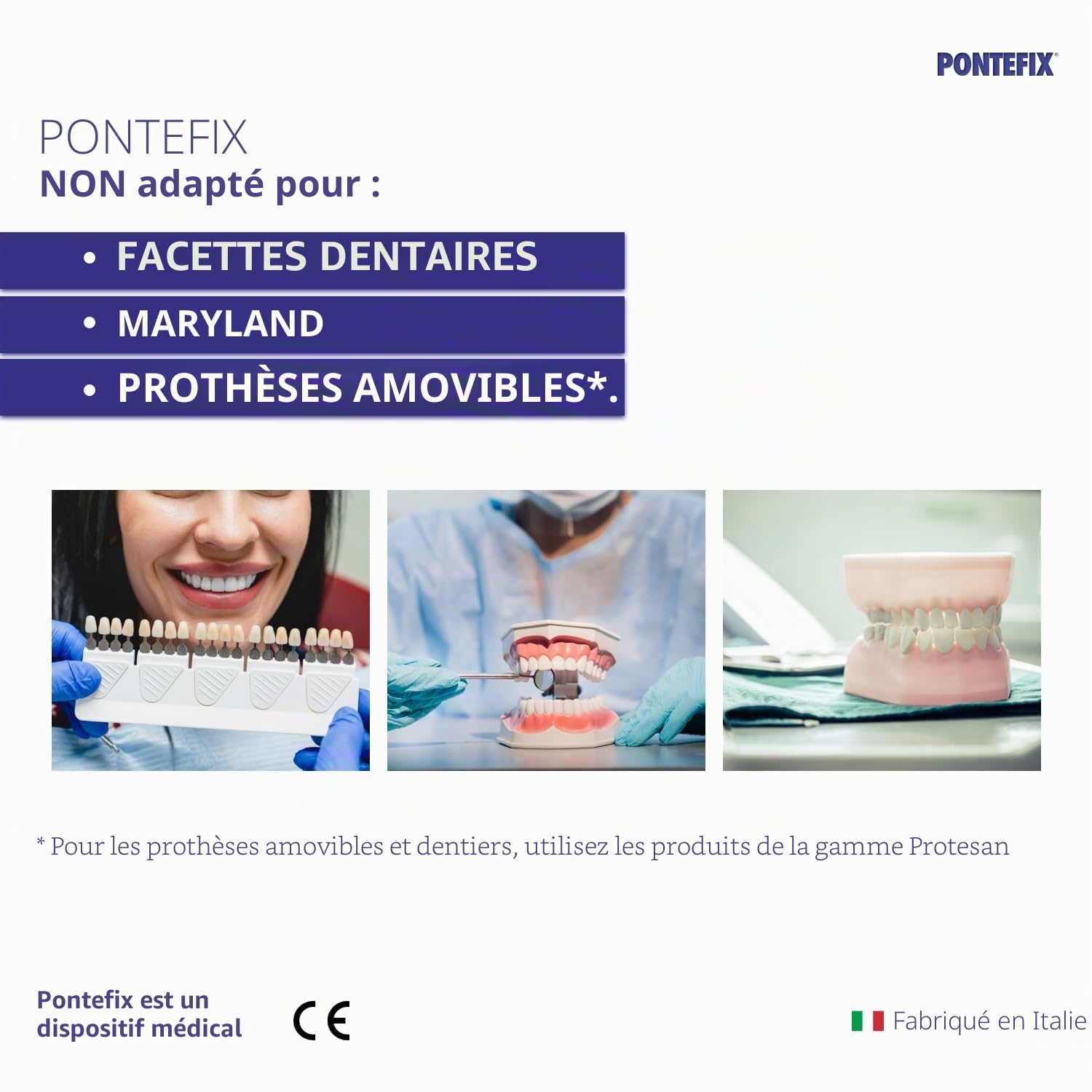 Ciment Dentaire, pour Resceller Couronnes ou Bridges- Fixe les Bridges, les Capsules Dentaires et les Dents Pivotantes